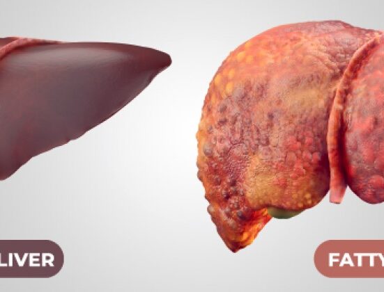 ফ্যাটি লিভার: এক বেখেয়ালি মারাত্মক ব্যাধির নাম